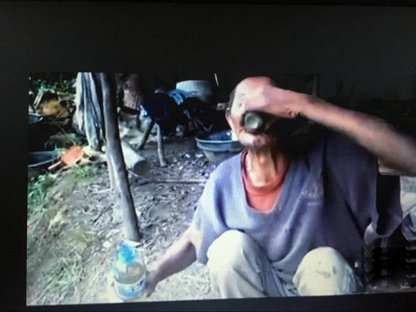 重庆老人喝汽油治咳嗽 竟喝了45年